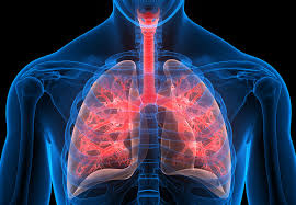 Fluid which may accumulate between the lung and chest. How You Can Help Reach The Right Cystic Lung Disease Diagnosis Health Essentials From Cleveland Clinic