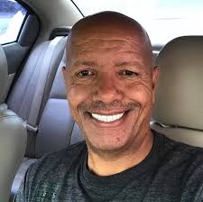 Is wiring orbit esp unit easy?