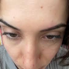 Estetik ve İzmir Şikayetleri