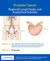 If breast cancer is diagnosed at an early enough stage, it's treatable. Ecancer On Twitter Our Tnm Classification Overview Looks At The Regional Lymph Nodes And Anatomical Subsites Of Prostatecancer Discover Cancer Staging For Prostate Cancer And More Tumour Types At Https T Co 5uo9axwxg8 And Prostatecancerawareness
