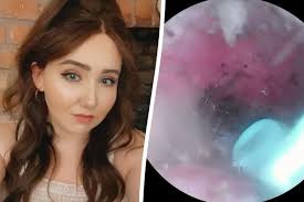Mum finds spider nest in her ear after complaining of 'crackling' and  'scratchy' pain