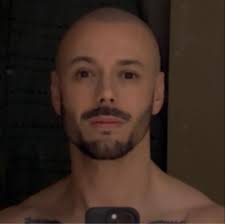 What is the ratio of surgical to non-surgical treatments for Achilles  tendon rupture?