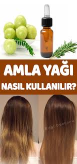 Dabur Amla Sac Bakim Yagi Nedir Ne Ise Yarar Nasil Kullanilir Kullanici Yorumlari Ve Sikayet Steemit