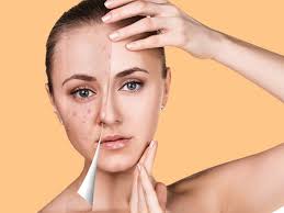 Salah satu tips penjagaan kulit muka untuk kekal glowing adalah dengan mengamalkan pemakaian sunscreen! Nak Kulit Cantik Tanpa Jerawat Bukannya Susah Cuba Buat Perkara Ini Sebelum Tidur Pesona Pengantin