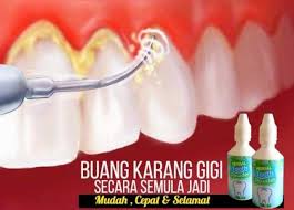 Jika pergi ke dokter gigi, dokter akan menggunakan bahan kimia dan alat canggih untuk memutihkan gigi secara instan. Kesan Pantas Menghilangkan Karang Gg Putih Gusi Sihat