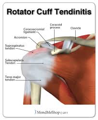The shoulder joint is composed of three bones: Shoulder Tendinitis