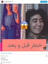 هل عندك افضل منة ؟.daha iyisi var mı.داها ايسي وار مي ؟ Ø¨Ø³Ø¨Ø¨ Ù‡Ø°Ù‡ Ø§Ù„ØµÙˆØ±Ø© Ù…ÙŠ Ø§Ù„Ø¹ÙŠØ¯Ø§Ù† ØªØ¹Ø±Ø¶ Ù‡Ø°Ù‡ Ø§Ù„ÙÙ†Ø§Ù†Ø© Ù„Ù„Ø³Ø®Ø±ÙŠØ© Ø¯Ù†ÙŠØ§ Ø§Ù„ÙˆØ·Ù†