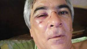 Un árbitro tucumano recibió una trompada en la cara, en pleno partido