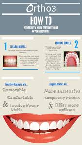 Invisalign is an alternative to braces but has minimal impact on your the invisalign plan uses a series of aligners made of a thermoplasticmaterial to straighten teeth, fix overcrowding, gaps, overbites and underbites. How To Straighten Your Teeth Without Anyone Noticing Sydney Ortho3