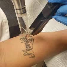 Price varies according to the size of the tattoo and the density of the ink to provide fair pricing. Atlantic Laser Tattoo Removal Tattoo Und Piercingstudio Virginia Beach Facebook 191 Fotos