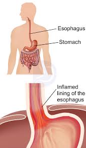 Image result for esophagus