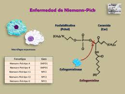 Affected is the enzyme sphingomyelinase. Niemann Pick Disease In 1914 Notas De Un Cientifico Facebook