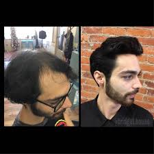 Check spelling or type a new query. Hair Replacement Bridget House Salon