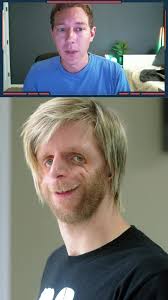 Abandoned at birth because of his looks!