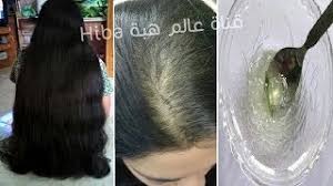 الوصفة المعجزة لانبات فراغات الشعر و الصلع في أسبوع أقسم بالله النتيجة ستبهرك ب4 مكونات فقط Youtube
