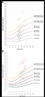 Bmi For Age Graphs Showing Longitudinal Bmi Data For 30