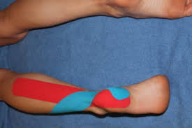 Image result for Taping for Soleus and Achilles