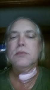 How long did it take for the beard to grow back?