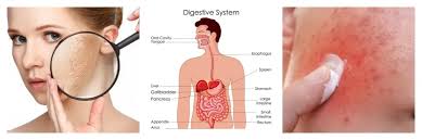 Turli xil sog'liq sharoitlari uchun Iblis panjasi ildizi ekstraktining  tavsiya etilgan dozasi qanday?