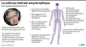 Accompagner et vaincre la maladie de charcot Qu Est Ce Que La Maladie De Charcot Dont Etait Atteint Stephen Hawking Sciences Et Avenir