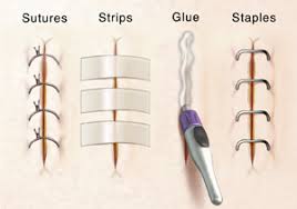 Wound Care