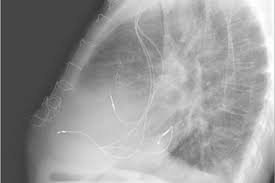 Clinical Review Chronic Heart Failure Gponline Images were downsampled by uniformly at random. clinical review chronic heart failure