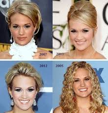 Carrie Underwood Plastic Surgery Before And After Photos Carrie Underwood Plastic Surgery Celebrity Plastic Surgery Plastic Surgery