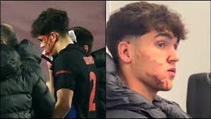 Cubarsí acabó sangrando por un corte en la cara al recibir una patada y le  dieron