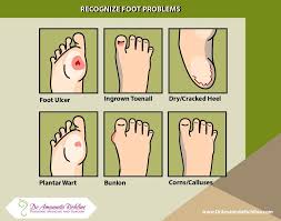 How Do Your Feet Look Can You Recognize These Common Foot Problems Ulcer Wart Dryskin Ulcers Warts Foot Problem