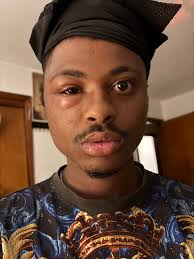 Wasp with white face and eyes in central Wyoming?