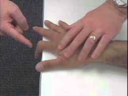 Image result for Elson Extensor Tendon Test