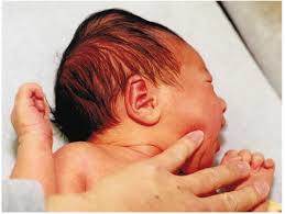 Image result for Vacuum Caput