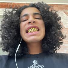 Custom Solid Gold Grillz