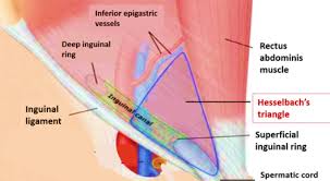 The conjoint tendon is a sheath of connective tissue that attaches the transversus abdominis, the deepest of the four abdominal muscles, to the pelvis. Inguinal Hernias Direct And Indirect Inguinal Hernias Differences And Coverings Anatomy Qa