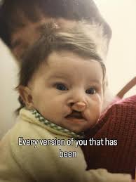 CleftLove: Learning...