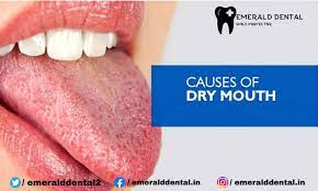 Causes Of Dry Mouth - Emerald Dental