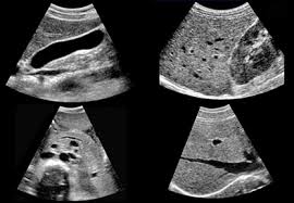 The test is painless and easy to tolerate. Women S Upper Abdominal Ultrasound Scan By Ultrasound Direct