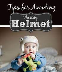 11 Plagiocephaly Ideas Flat Head Syndrome Baby Helmet Baby Head