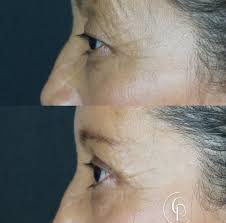 Hola! Soy Cristian Daniel Piñon Hernández y quiero platicarles un poco de  mi formación académica: • Me formé como Medico Cirujano y Partero en la  Facultad de Medicina de la Universidad Autónoma