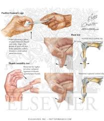 Image result for Hand Exam