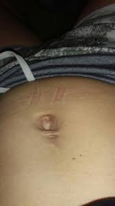 Could I Get My Belly Button Repeirced Glow Community