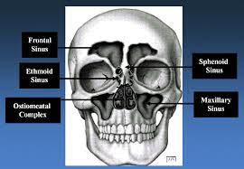 Headaches Caused By Nasal And Paranasal Sinus Disease Neurologic Clinics