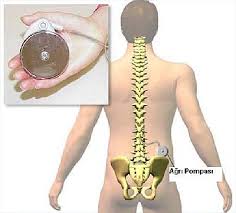 Kanser Agrisinin Tedavisi