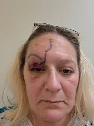 Anyone know what happened in front of the hospital and lifecare?