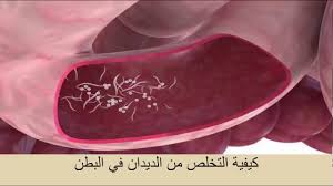 علاج الديدان عند الكبار الديدان لها اضرار كثيره صور حزينه