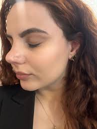 Septum repair surgery recommendations in the area