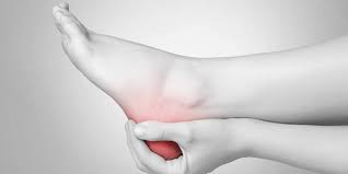 Как баран на новые ворота. Mal Au Talon Et Si C Etait Une Aponevrosite Plantaire Le Point