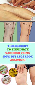 Pin On Fashion Gifts Foods That I Love