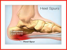 Pin On Fit Ted Feet Ankles