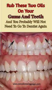 Rub These Two Oils On Your Gums And Teeth Mind Blowing Page Teeth Health Clove Essential Oil Essential Oil Blends